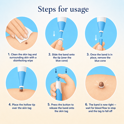 Dervalon™ Skin Tag Removal Kit