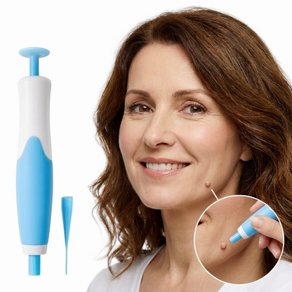 Dervalon™ Skin Tag Removal Kit